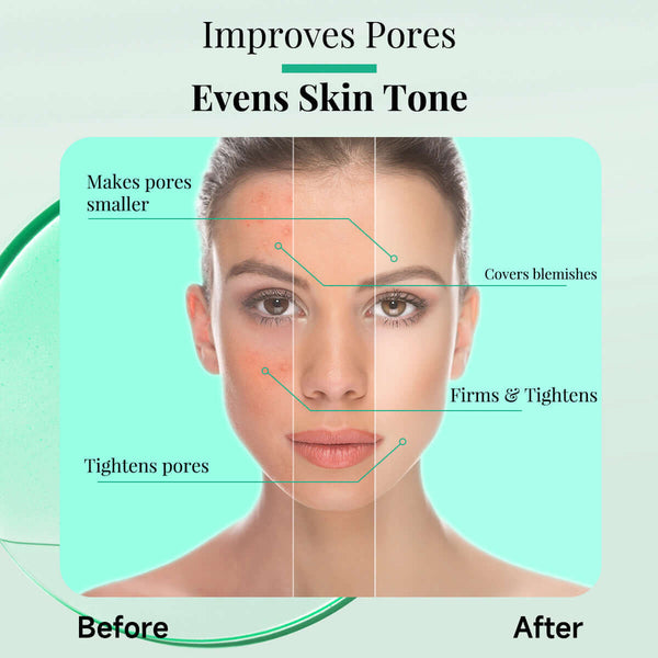 Before and after skin improvement showing enhanced pore appearance and even skin tone benefits.