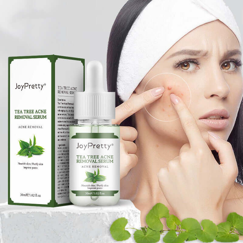 JoyPretty Tea Tree Acne Removal Serum in liquid form, effective for fading acne marks, with a woman applying it to her skin.