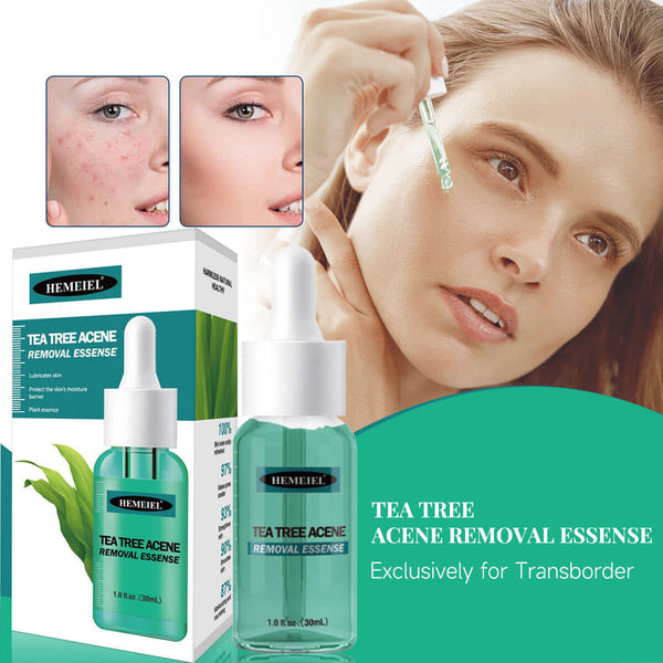 Tea Tree Acne Removal Essence for oily skin, 30ml facial care solution, effective acne treatment and hydration.
