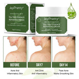 JoyPretty Tea Tree Essence Repairing Cream showing before, day 7, and day 14 results for acne and skin smoothening.