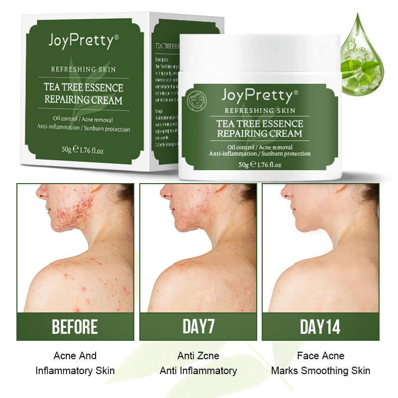 JoyPretty Tea Tree Essence Repairing Cream showing before, day 7, and day 14 results for acne and skin smoothening.