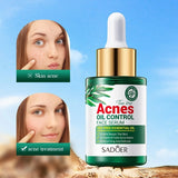 Tea Tree Hydrating Acne Control Oil serum with applicator, effective for acne treatment and skin repair, 30ml size.