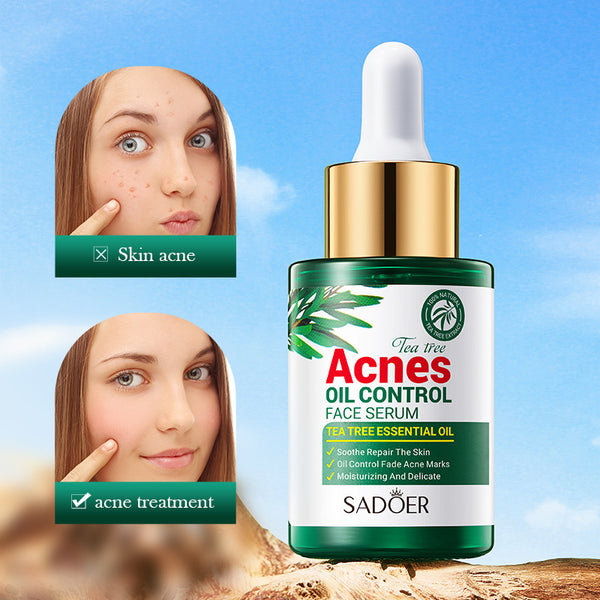 Tea Tree Acne Control Oil for hydrating skin, reducing acne, and improving skin texture - 30ml facial essence.