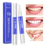 Teeth whitening pen with before and after results, effective for removing stains and brightening teeth.