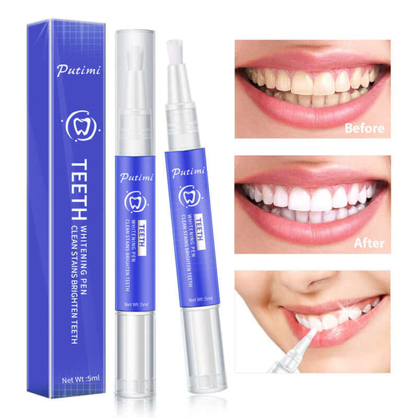 Teeth whitening pen with before and after results, effective for removing stains and brightening teeth.