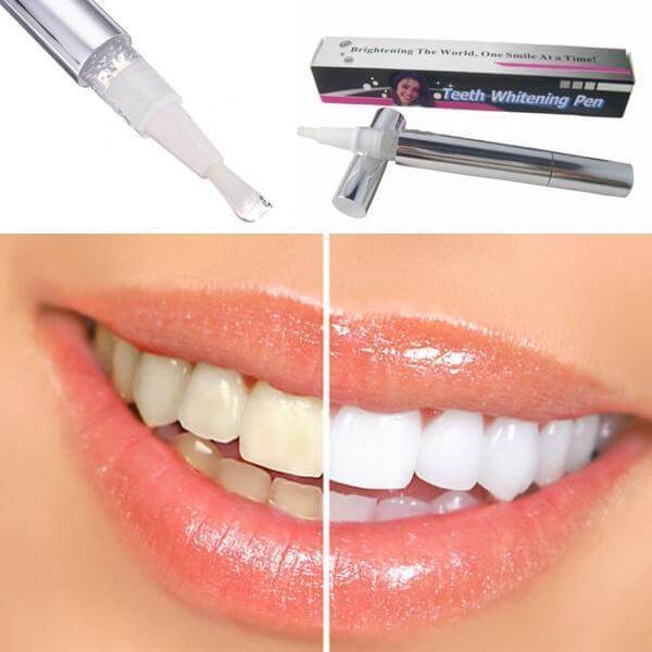 Teeth whitening pen next to close-up of lips showing before and after results of teeth whitening.