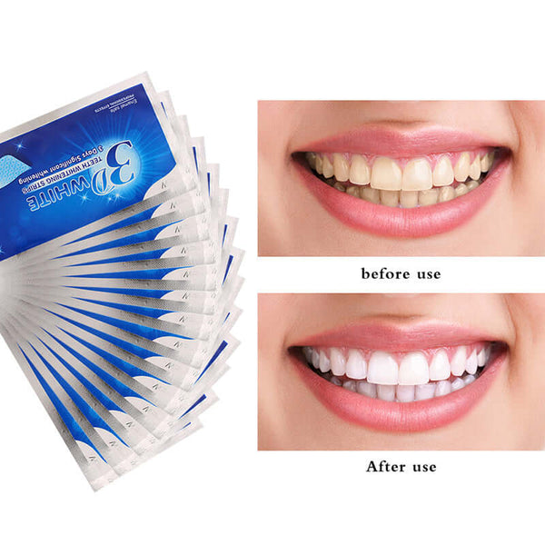 Teeth whitening strips before and after use showcasing improved smile and whiter teeth results.