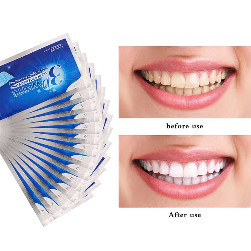 Teeth whitening strips for a brighter smile, showing before and after results of tooth discoloration treatment.