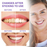 Before and after teeth whitening results showing improved smile with product effects.